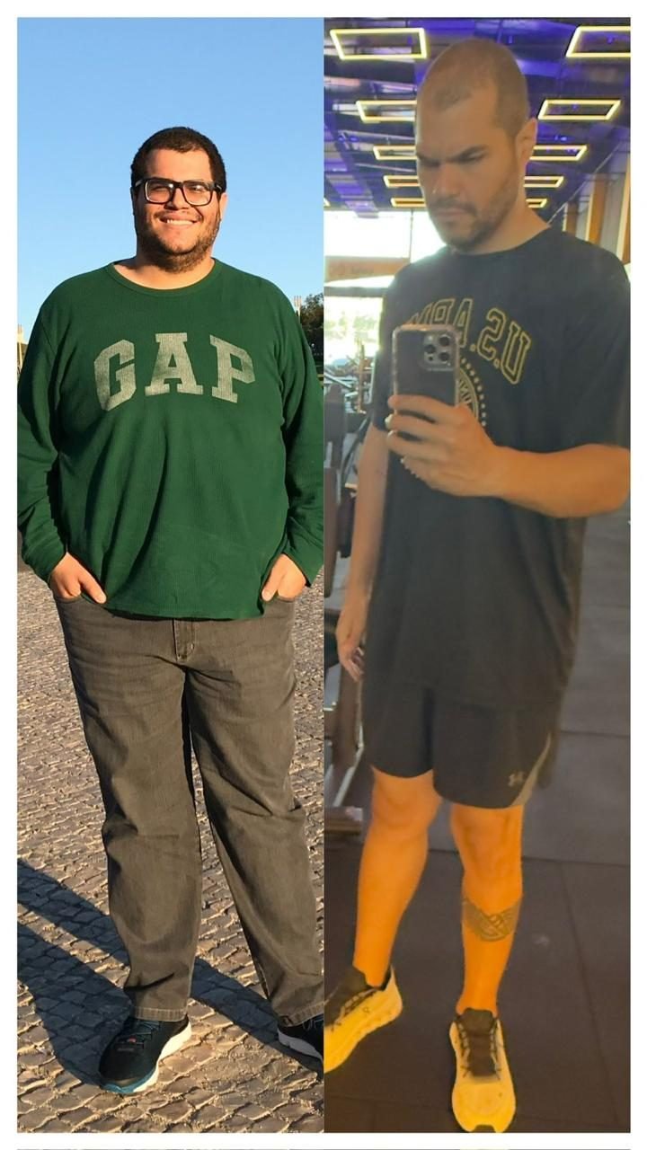 Antes e depois caso 07