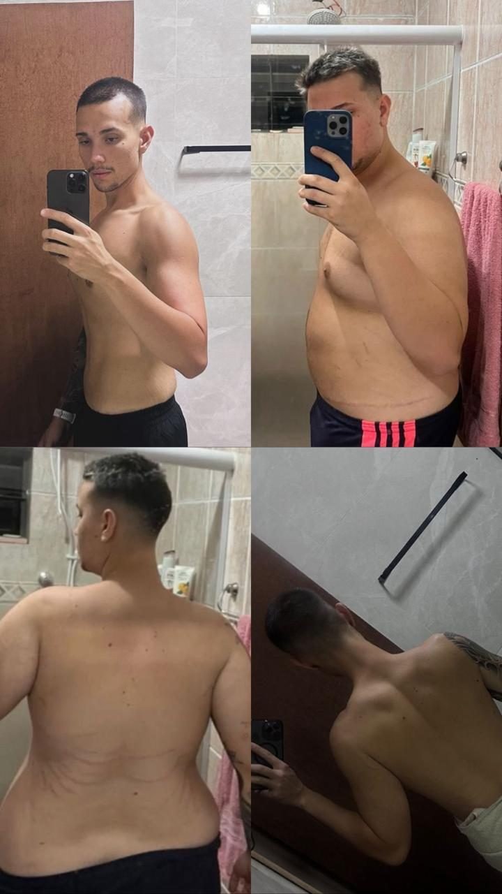 Antes e depois caso 08